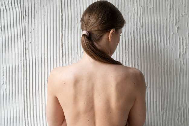 Методы лечения фурункула на спине