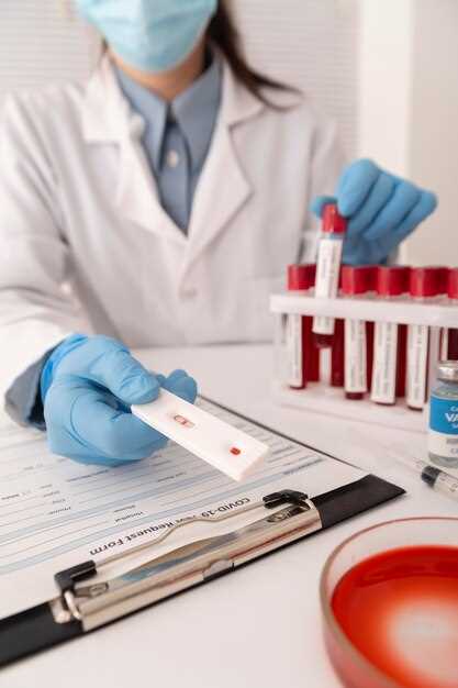 Как происходит анализ крови на ВИЧ