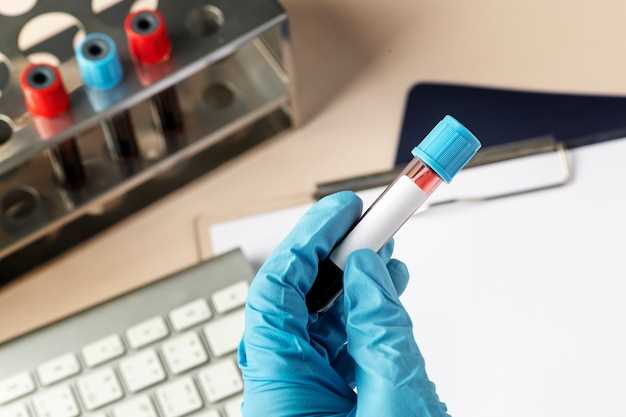 Подготовка к анализу крови на биохимию: основные правила