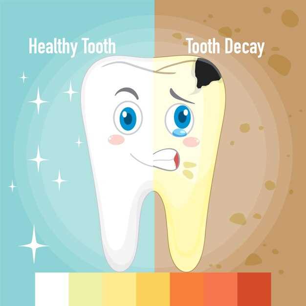 Как выбрать правильный цвет для зубов?