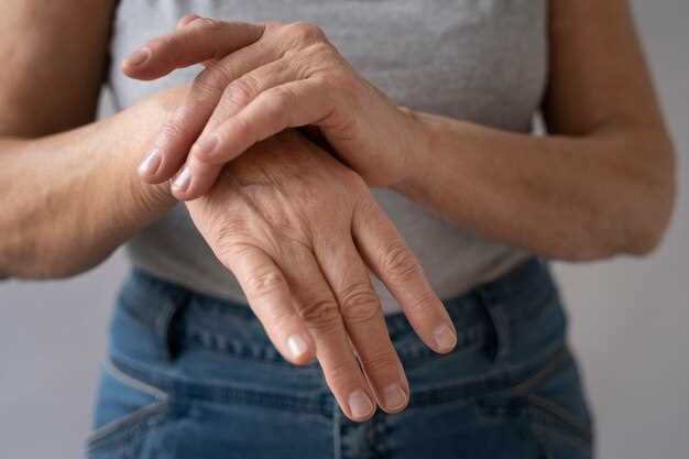 Псориатический артрит: симптомы и лечение