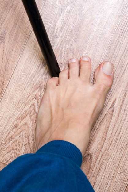 Как правильно диагностировать и лечить синеющий палец на ноге