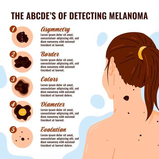 Основные признаки злокачественных образований на коже